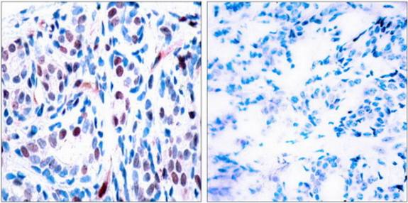 STAT3 (Phospho-Tyr705) antibody