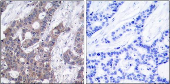 Stathmin 1 (Phospho-Ser15) Antibody