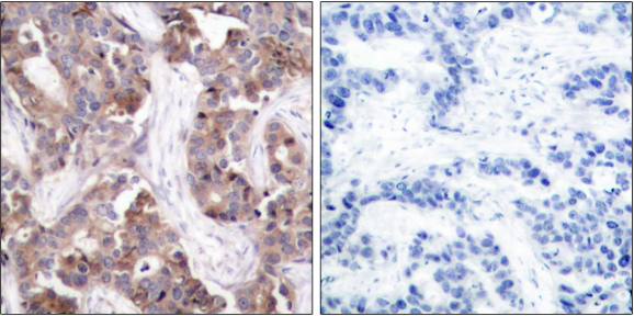 Stathmin 1 (Phospho-Ser24) Antibody
