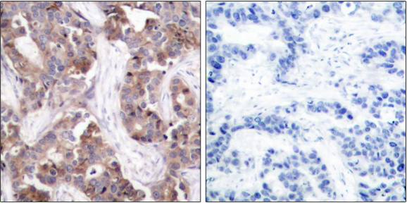 Stathmin 1 (Phospho-Ser24) antibody