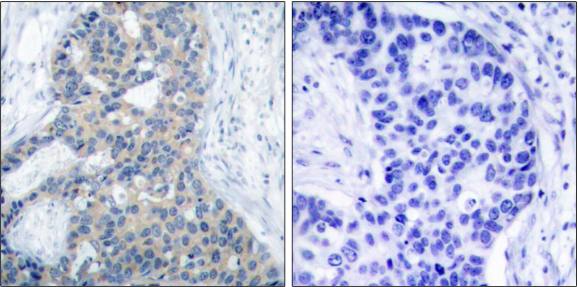 Stathmin 1 (Phospho-Ser37) antibody