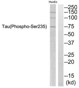 Tau antibody