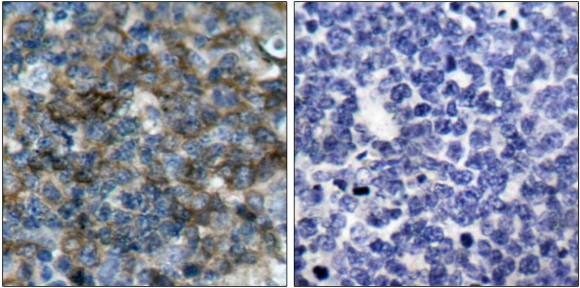 VASP (Phospho-Ser157) antibody