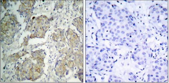 VEGFR2 (Phospho-Tyr1214) antibody