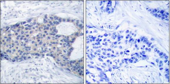 ZAP-70 (Phospho-Tyr493) Antibody