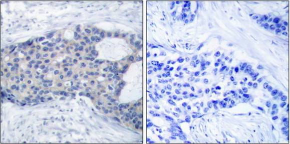 ZAP-70 (Phospho-Tyr493) antibody