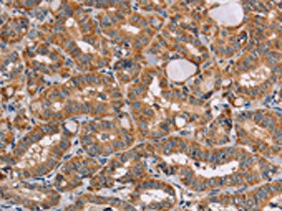 AAAS Antibody
