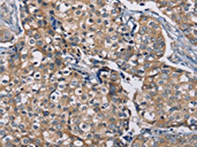 AAAS Antibody