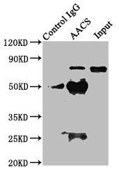 AACS antibody