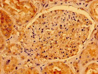 AACS Antibody