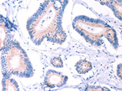 AADAC Antibody