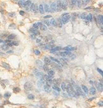 AADAC Rabbit Polyclonal Antibody