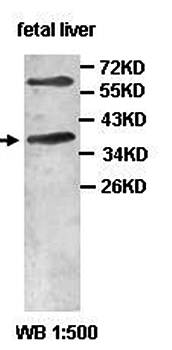 AADAC antibody