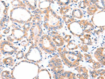 AADACL2 Antibody