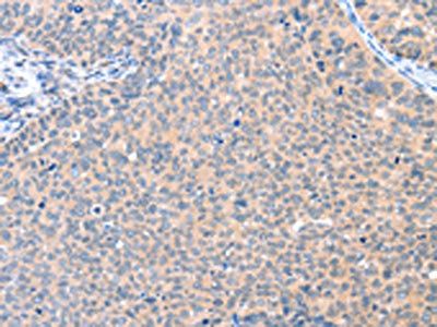 AADACL2 Antibody