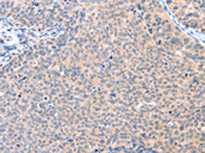 AADACL2 antibody