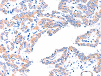 AADACL2 Antibody