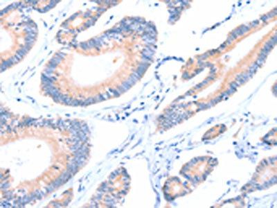AADACL2 Antibody