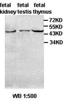 AADACL4 Rabbit Polyclonal Antibody