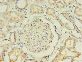AADAT Antibody