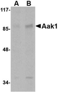 Aak1 Antibody