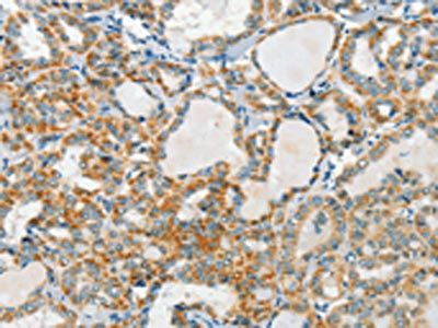 AANAT Antibody