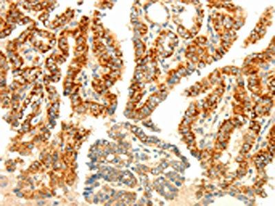AARS2 Antibody
