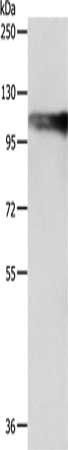 AARS2 Antibody