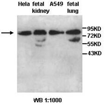 AARSD1 antibody