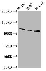 AASS antibody