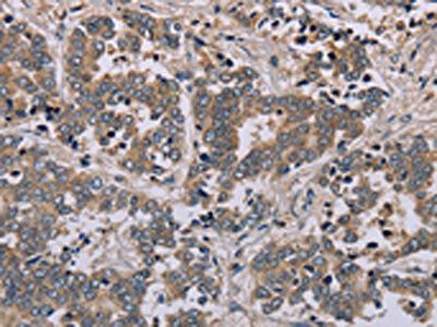 AATK Antibody