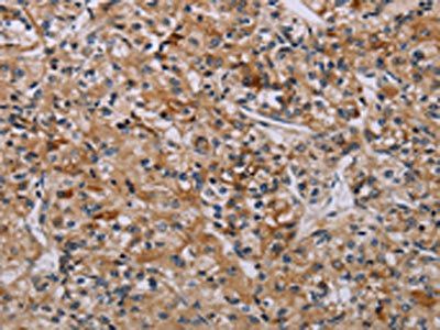 AATK Antibody