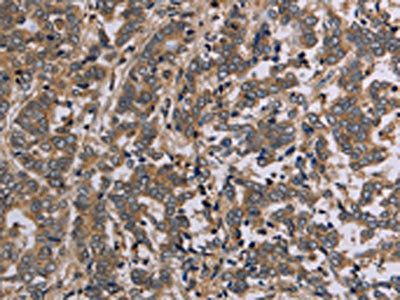 AATK Antibody