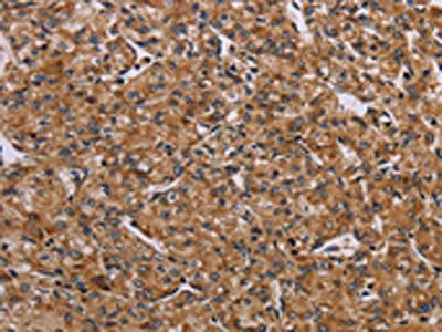 AATK Antibody