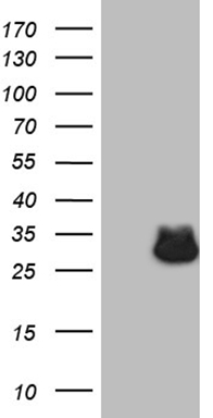 ABAT Antibody