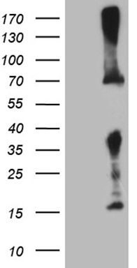 ABAT Antibody