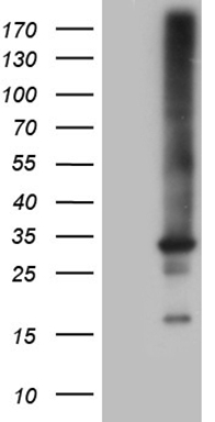 ABAT Antibody