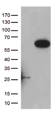 ABAT Antibody