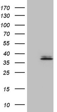ABAT Antibody