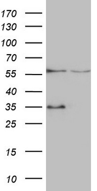 ABAT Antibody