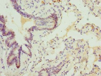 ABCA3 Antibody