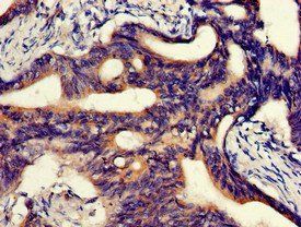 ABCA5 Antibody