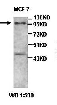 ABCA5 Rabbit Polyclonal Antibody