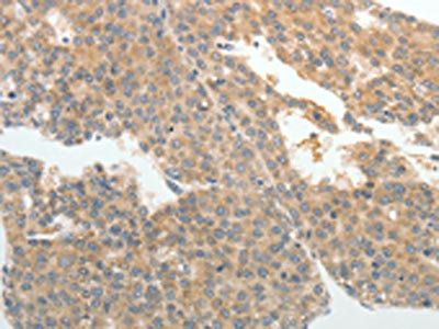ABCB11 Antibody