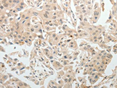 ABCB11 Antibody