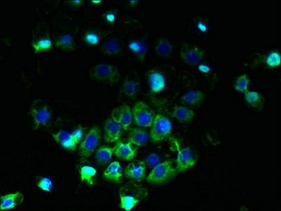 ABCB5 antibody