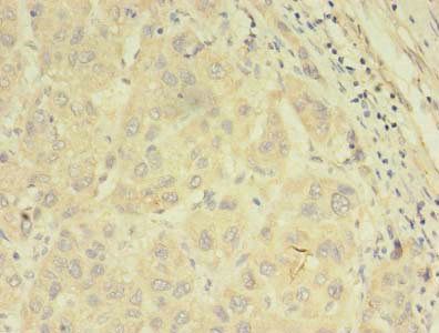 ABCB5 Antibody
