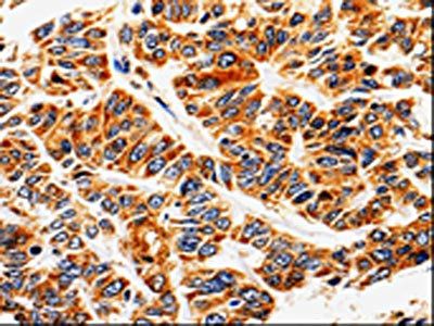 ABCB5 Antibody