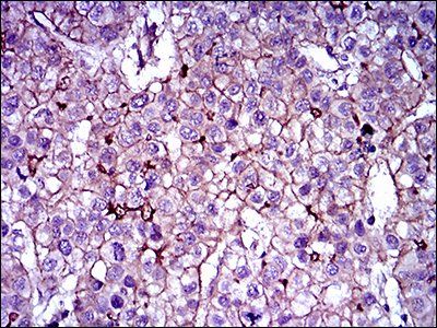 ABCB5 Antibody