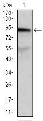 ABCB5 Antibody